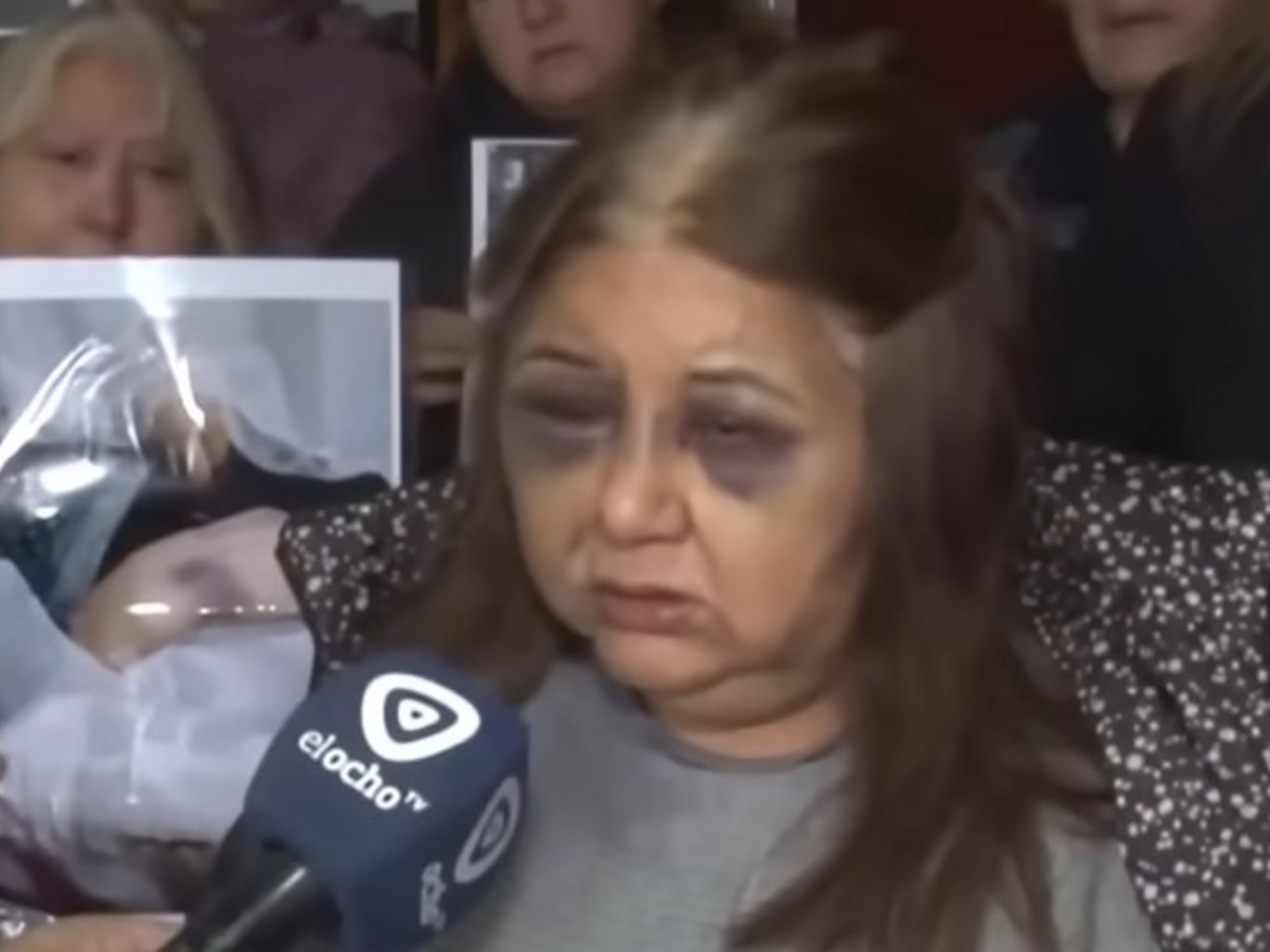 Con los ojos morados y los dedos vendados, habló la esposa del hombre que mató a su suegra a bastonazos: "Socorro, vecinos"
