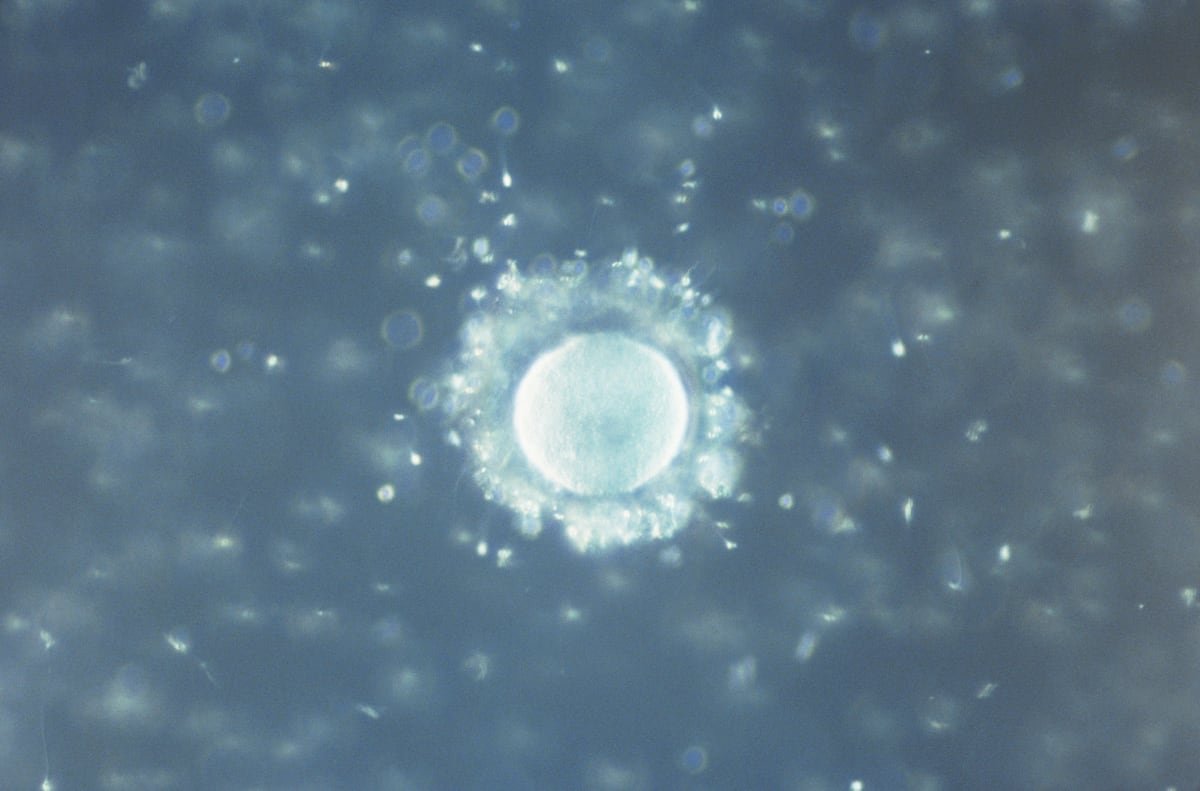 Microplásticos hasta en el semen y los ovarios | Salud y bienestar