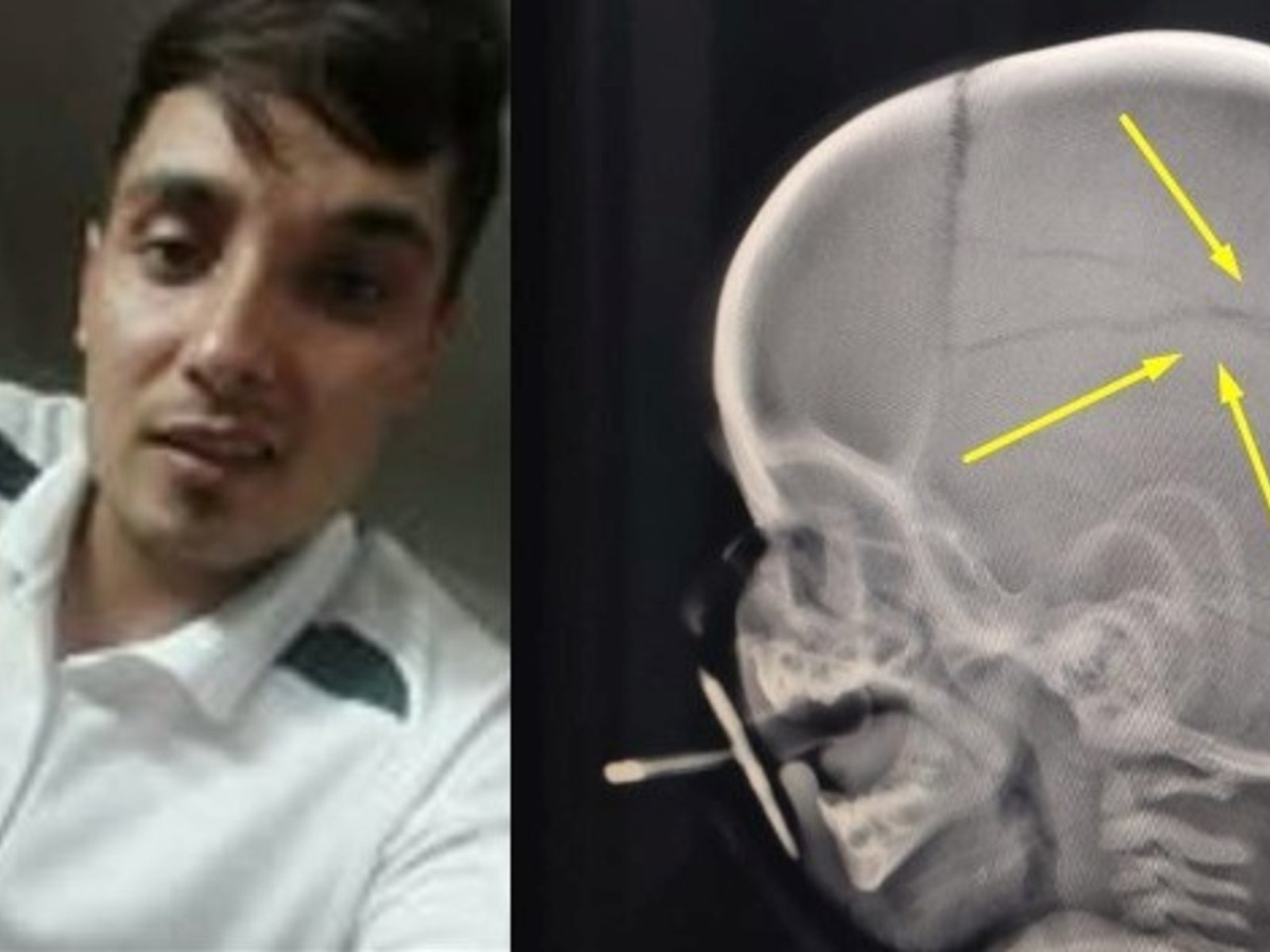 Liberó a un golpeador de niños y lo mandó a un curso de «deconstruyendo masculinidades»: volvió a atacar