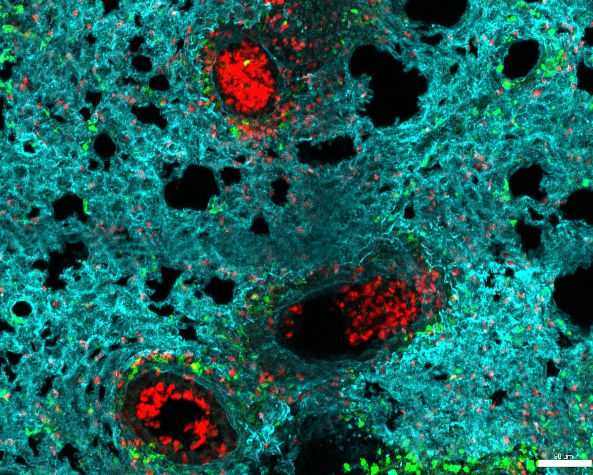 El mapa de los neutrófilos: crean una herramienta para combatir el cáncer o las infecciones con las células inmunes más abundantes | Salud y bienestar