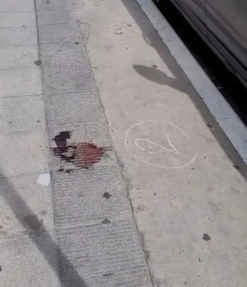 Un hombre fue apuñalado en el cuello y detuvieron a su expareja