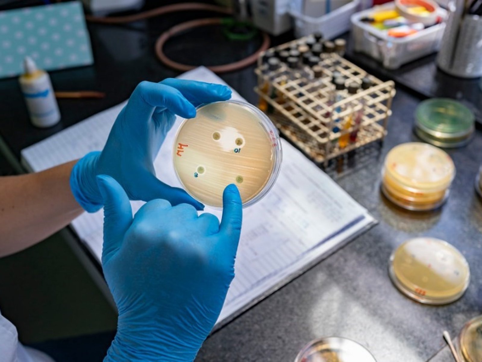 Detectaron la «supergripe» H3N2 en ocho provincias de Argentina y el 30% de los casos derivó en internación