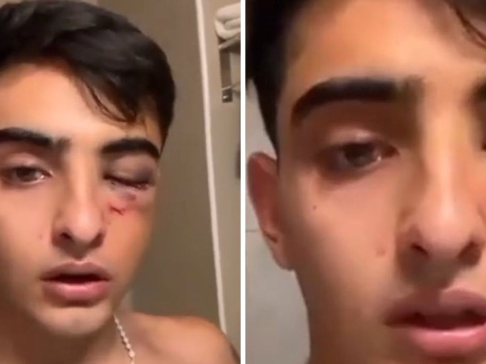 Salvaje ataque en patota de un grupo de rugbiers a un joven de 19 años a la salida de un boliche en Tucumán: "No me puedo mover"