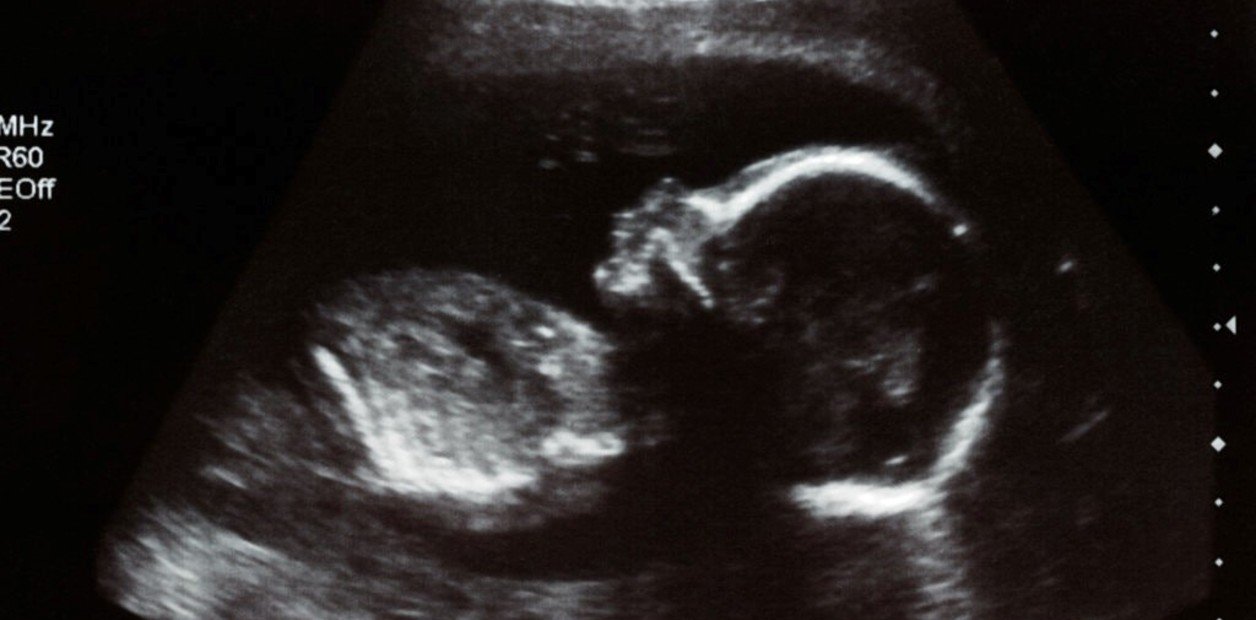 La Justicia de Rosario ordenó la vacunación de un bebé que está por nacer, a pesar de la negativa de los padres