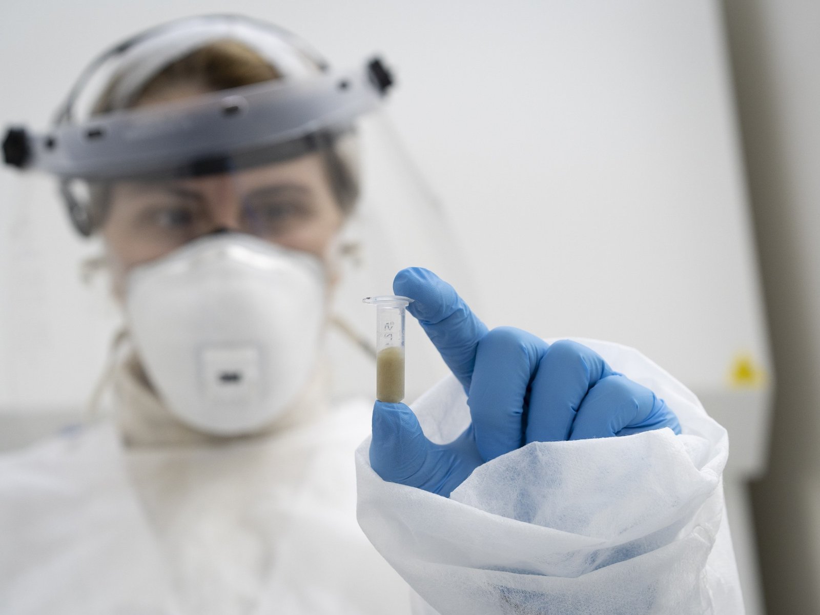 Crecen los casos de hepatitis A en el país y encontraron otro virus poco conocido en las aguas residuales de la Ciudad y el Conurbano