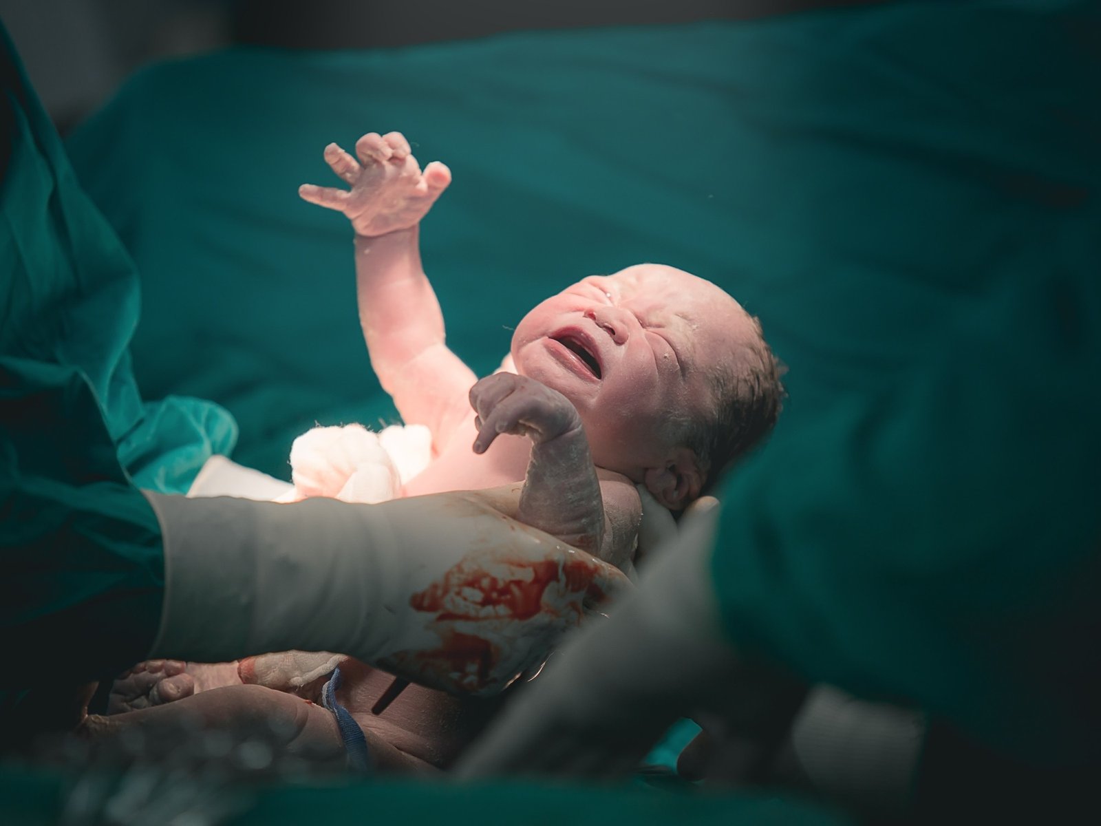 Estudiaron si la inyección epidural para un parto sin dolor causa daño neurológico en los bebés: los resultados
