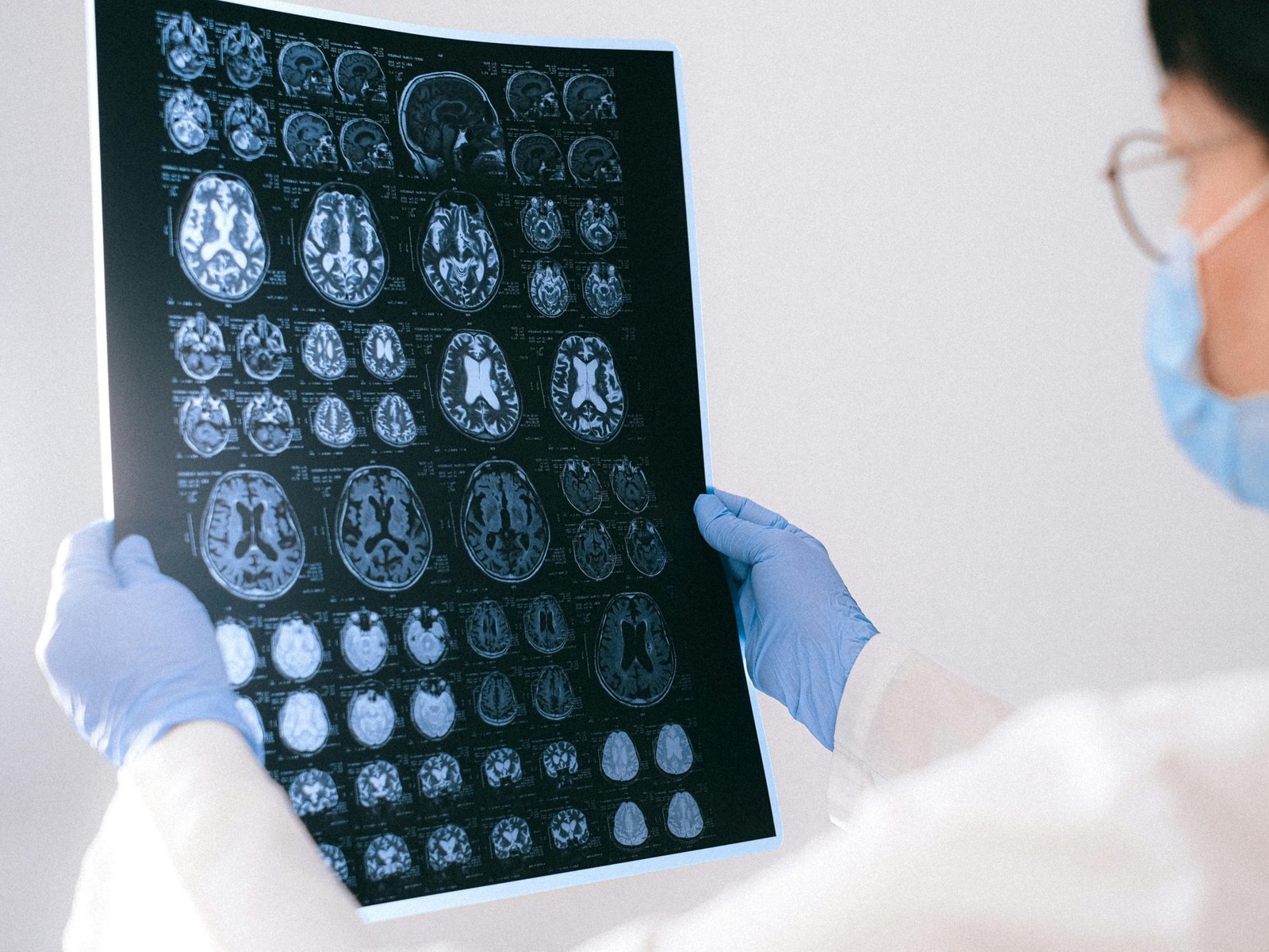 Exitosa prueba en humanos para evitar el Alzheimer con un método que fortalece el sistema inmune del cerebro