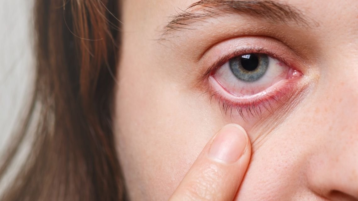 Invierno, pantallas y calefacción: una combinación que dispara los casos de “ojo seco”