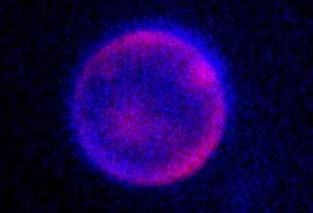 Una de las células sintéticas creadas por el laboratorio de Kate Adamala, vista con microscopía.