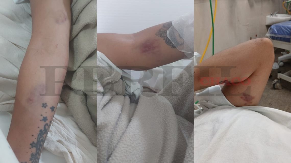 La hija de Marcela Acuña denunció a su expareja por golpes y amenazas: “Tengo miedo”