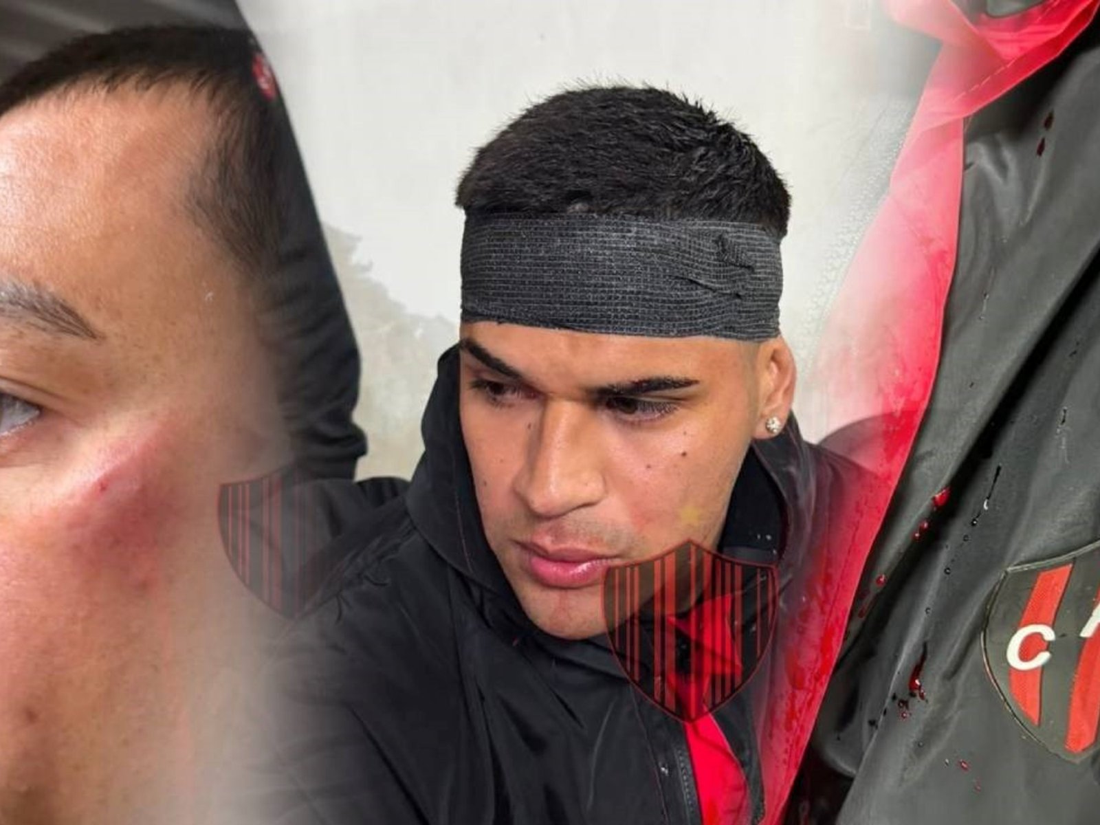Repudiable: la agresión de la barra a los jugadores de Patronato :: Olé