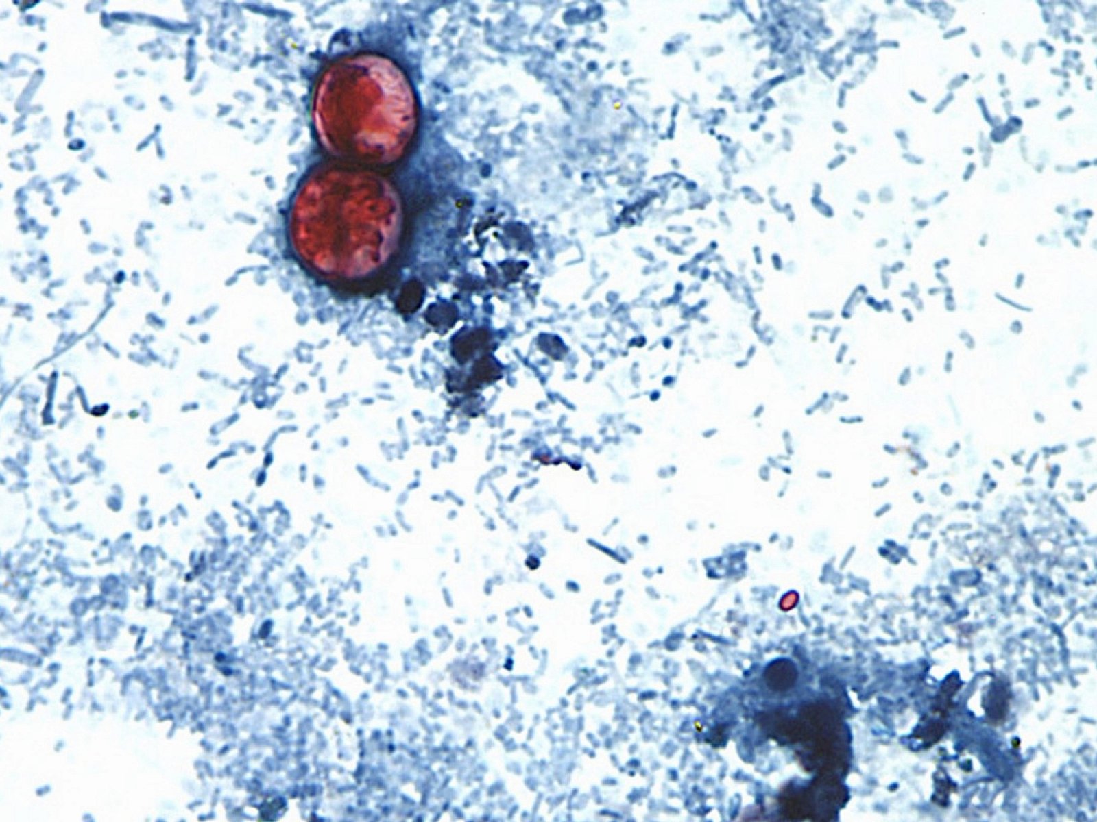 Qué es la Cyclospora, el parásito hallado en la lechuga contaminada que provoca diarrea y otros síntomas